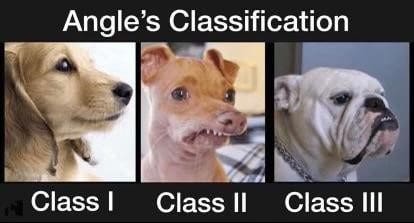 Angles Classification