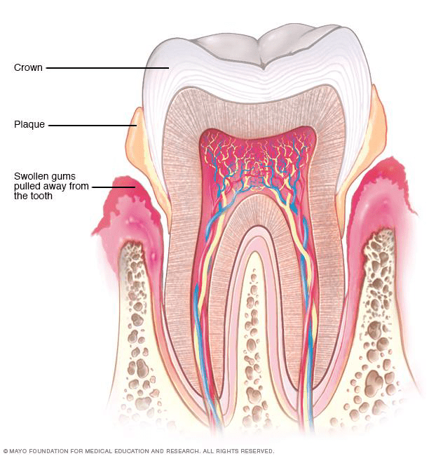 Periodontics illustration